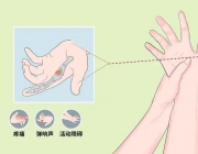 超声波治疗对腱鞘炎的治疗作用