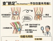 膝关节疼痛康复示意图一览