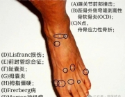 踝关节疼痛损伤位置对照