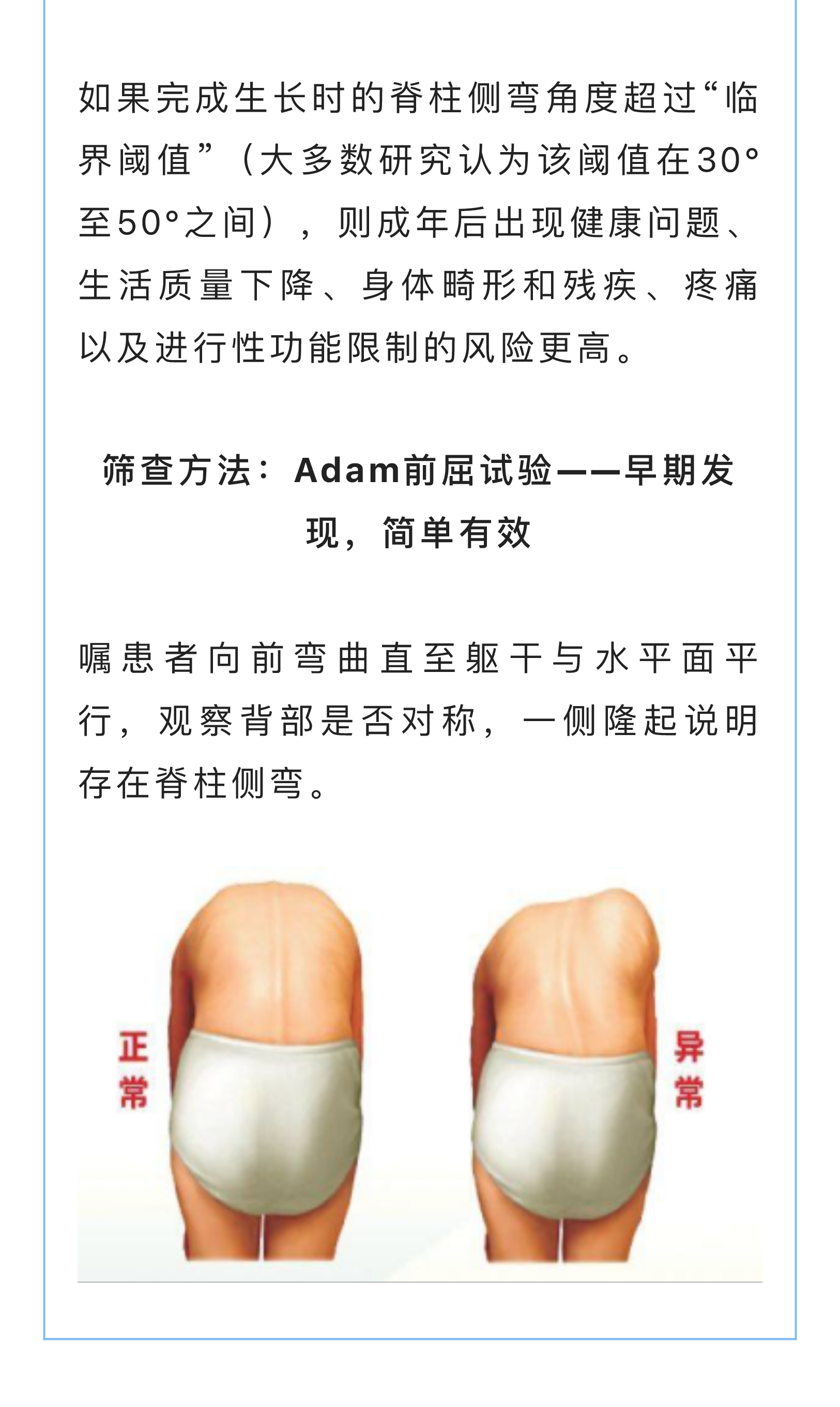 得了脊柱侧弯必须戴支具？运动康复帮您矫正_03.jpg